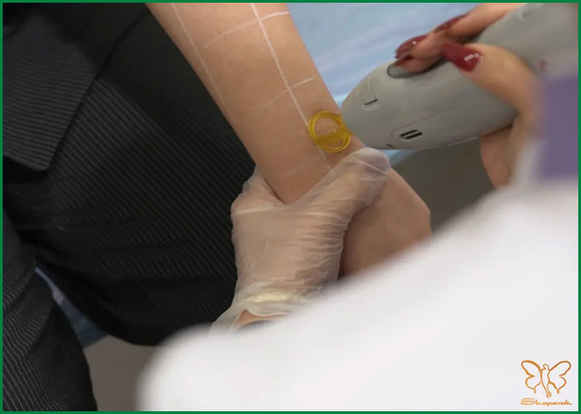 ویژگیهای منحصربهفرد کندلا جنتل لیز